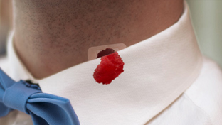 Come togliere le macchie di sangue