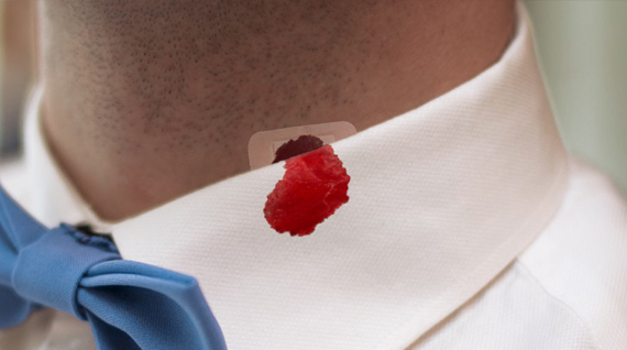 Leonardoda Trekker lijden Bloedvlekken verwijderen | Hoe krijgt u bloedvlekken uit kleding?